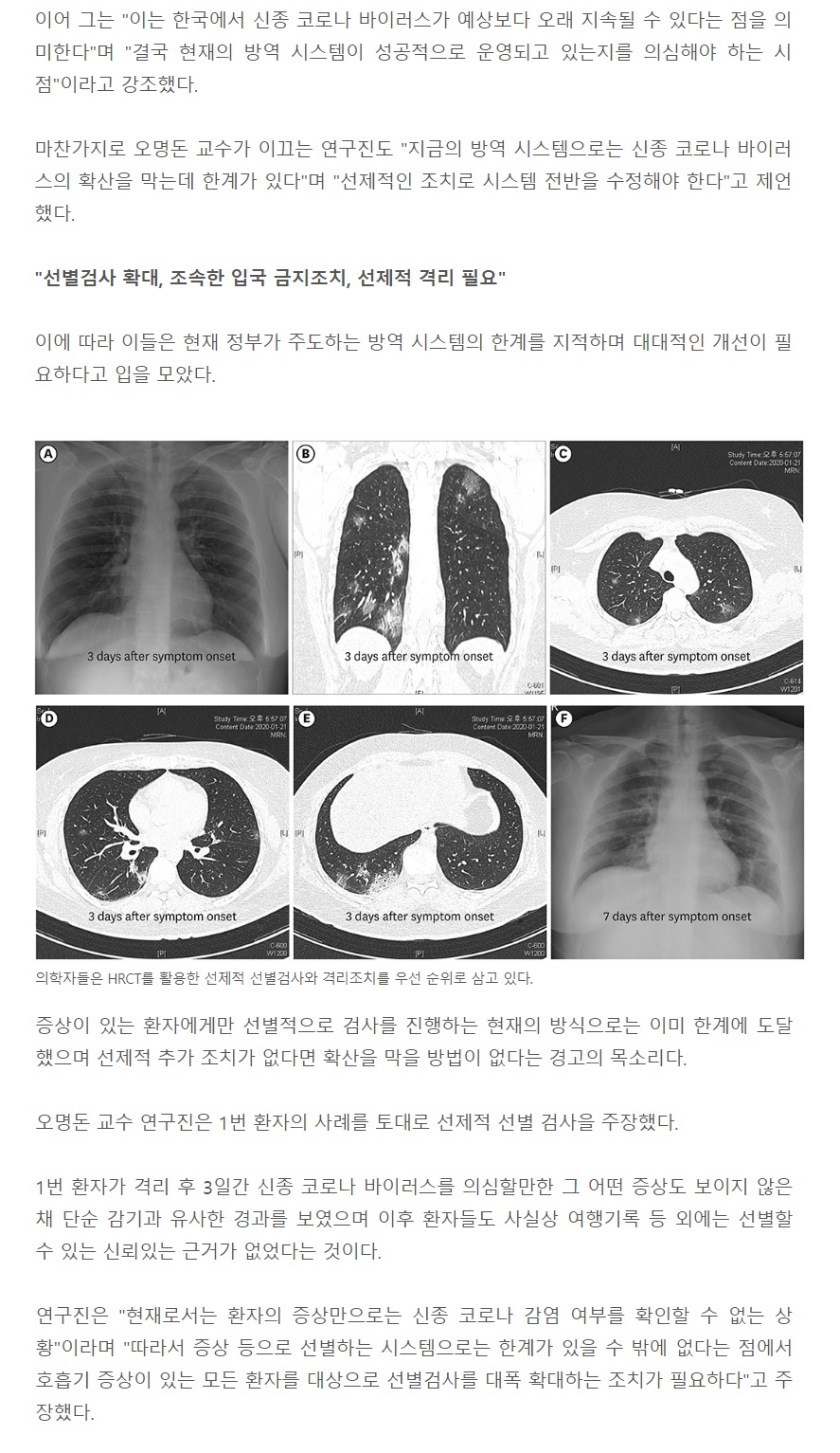 선제적.jpg